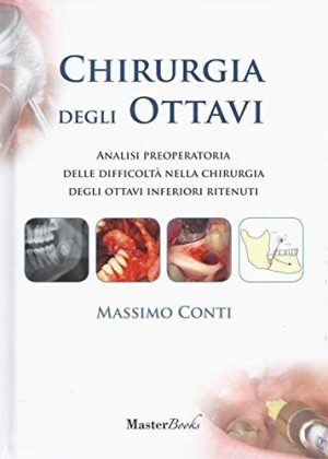 Chirurgia degli ottavi. Analisi preoperatoria delle difficoltà nella chirurgia degli ottavi inferiori ritenuti