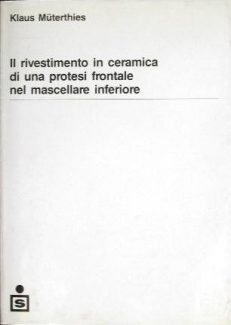 Il rivestimento in ceramica di una protesi frontale nel mascellare inferiore
