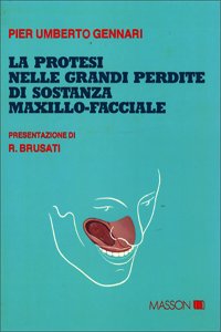 LA PROTESI NELLE GRANDI PERDITE DI SOSTANZA MAXILLO-FACCIALE
