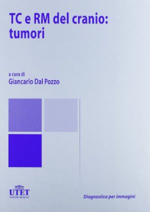 TC e RM del cranio: tumori