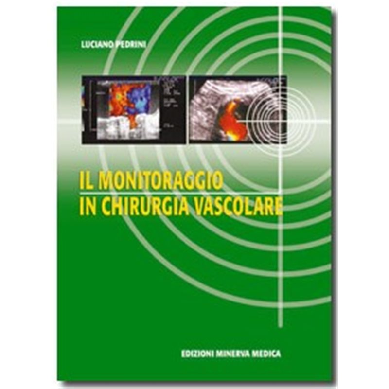 Il monitoraggio in chirurgia vascolare