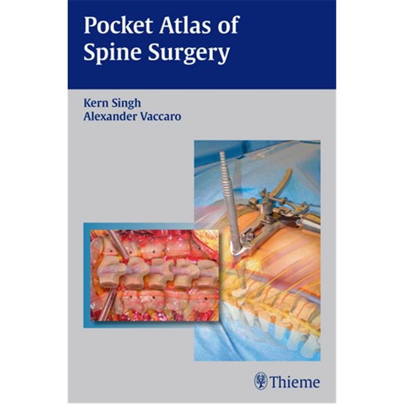 Pocket Atlas of Spine Surgery