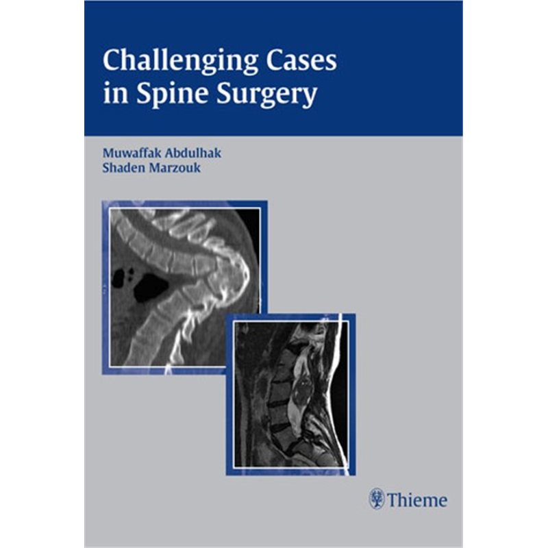 Challenging Cases in Spine Surgery