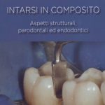 Intarsi in composito - Aspetti strutturali, parodontali ed endodontici