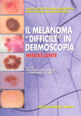 IL MELANOMA "DIFFICILE" IN DERMOSCOPIA. Miniatlante.