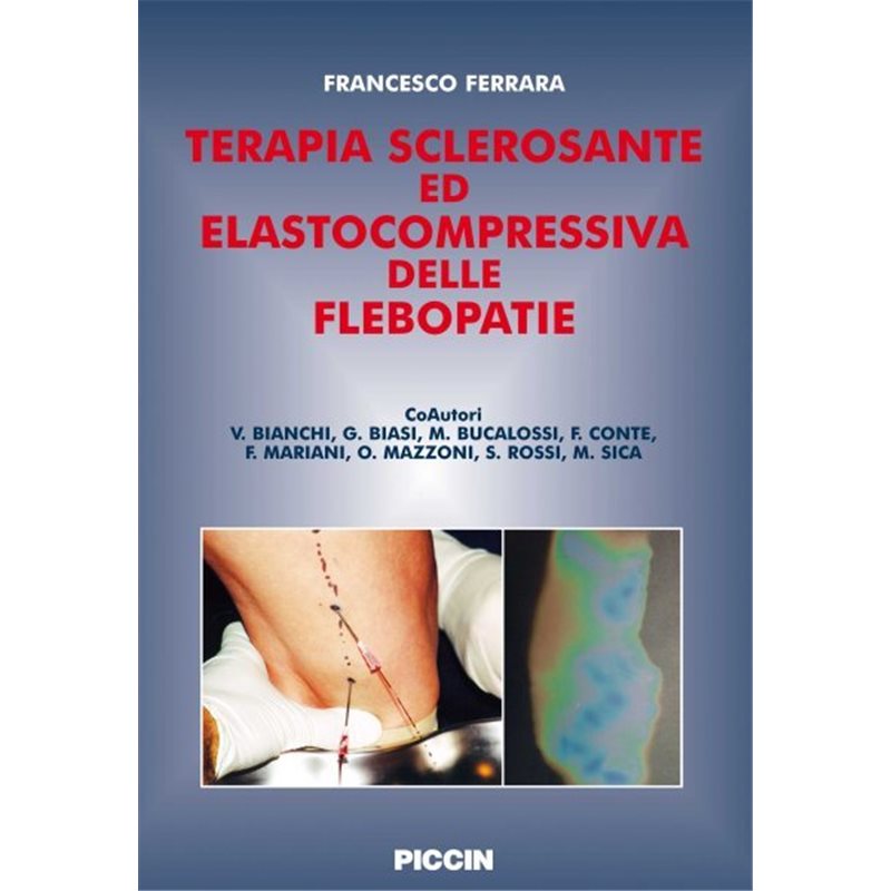 Terapia sclerosante ed elastocompressiva delle flebopatie