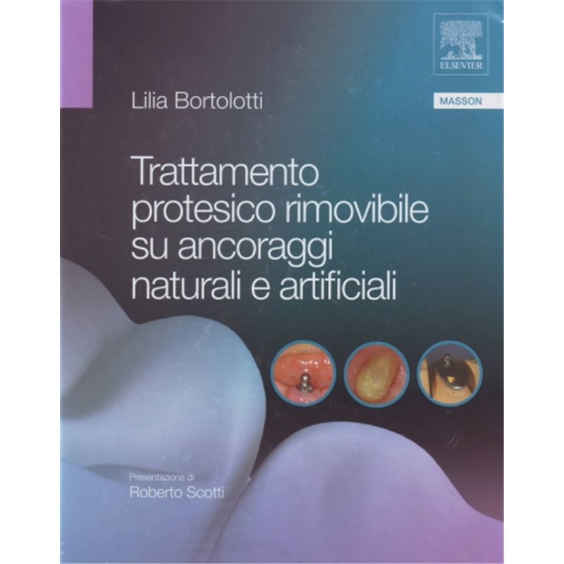 Trattamento protesico rimovibile su ancoraggi naturali e artificiali