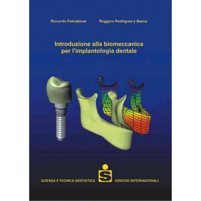 Introduzione alla biomeccanica per l&rsquo;implantologia dentale