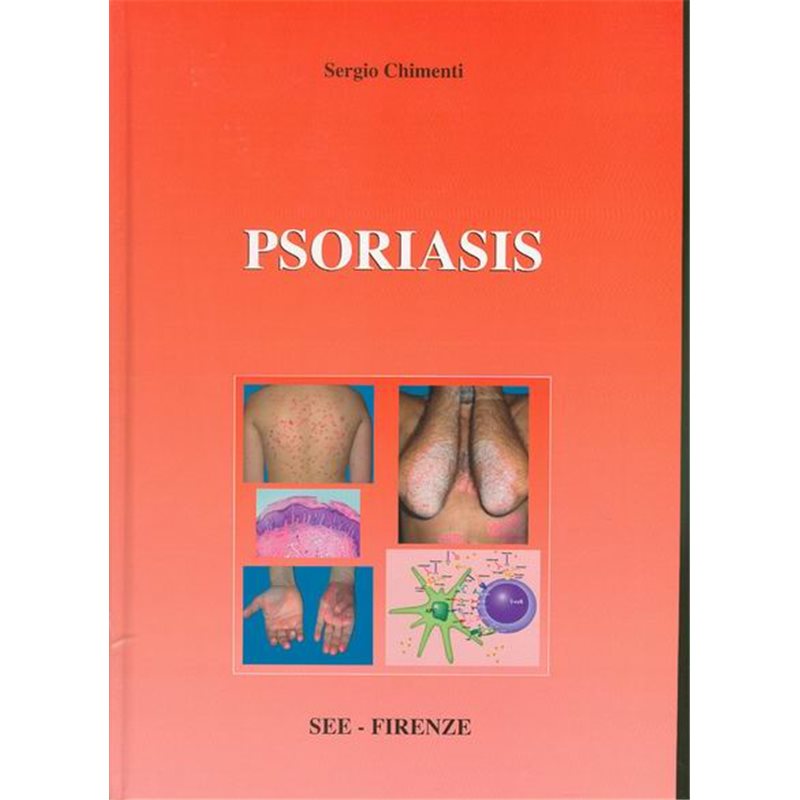 PSORIASIS