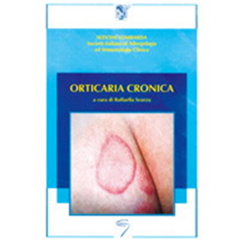 ORTICARIA CRONICA