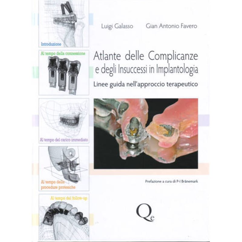 Atlante delle Complicanze e degli Insuccessi in Implantologia - Linee guida nell'approccio terapeutico