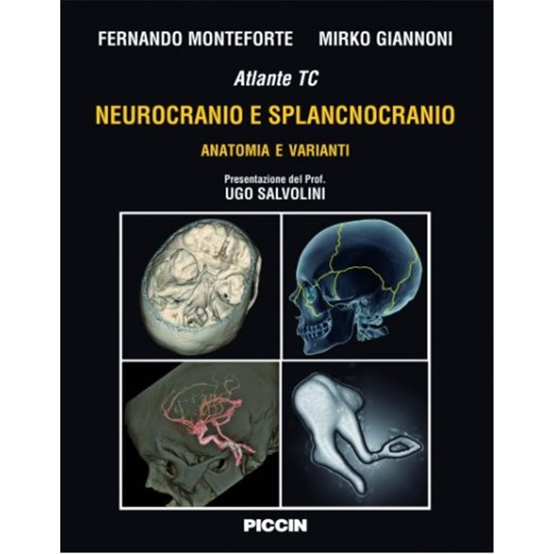 Atlante tc Neurocranio e Splancnocranio