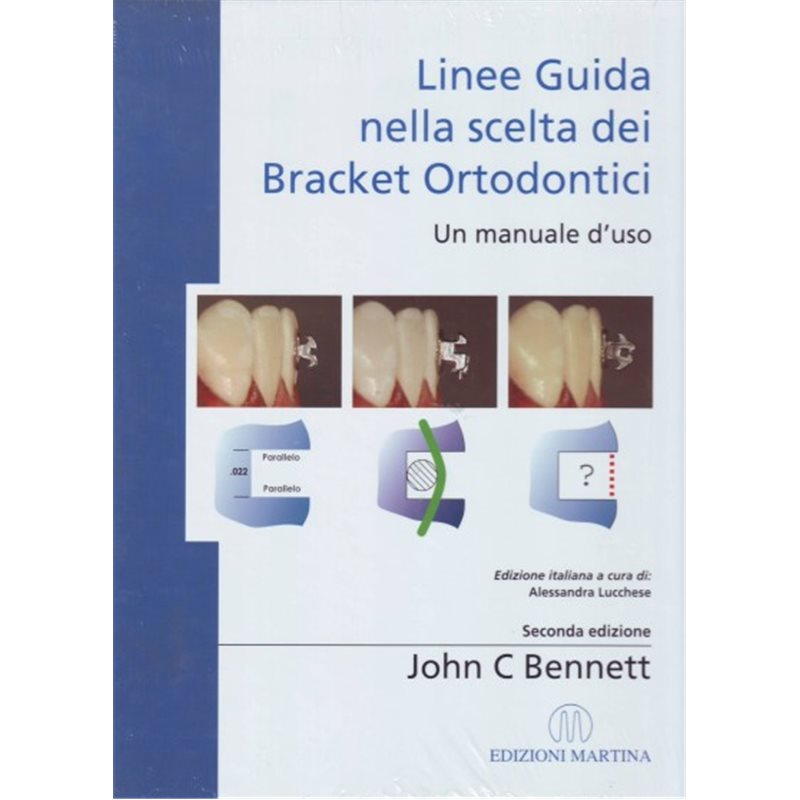 Linee guida nella scelta dei Bracket ortodontici - Un manuale d'uso