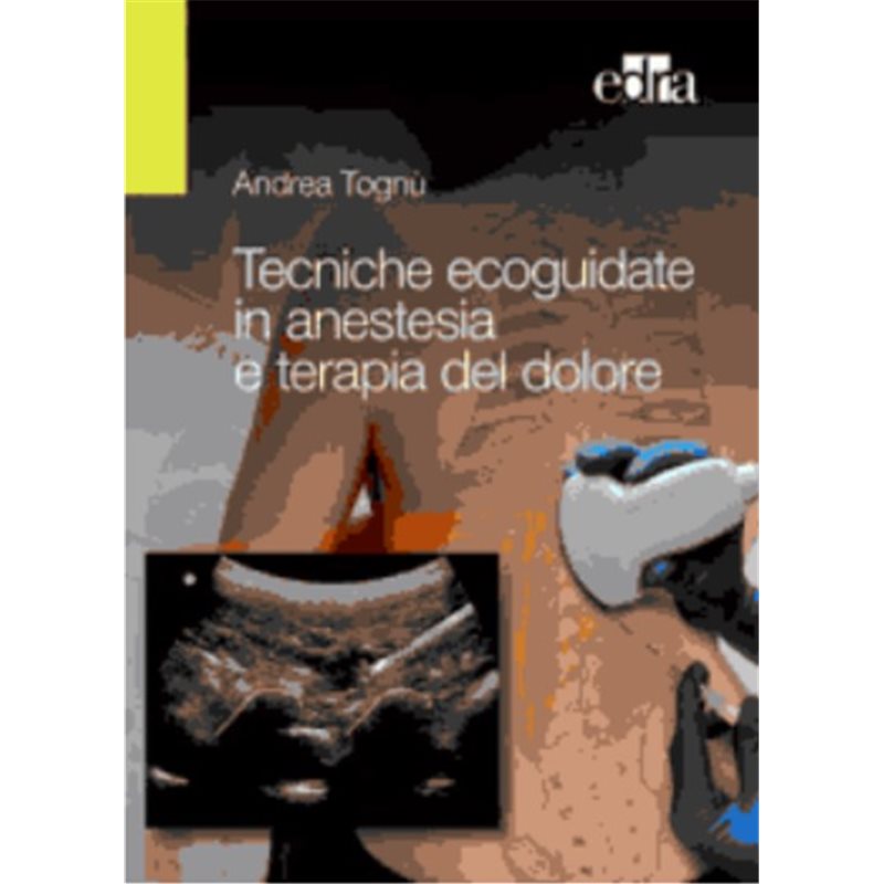 TECNICHE ECOGUIDATE IN ANESTESIA E TERAPIA DEL DOLORE