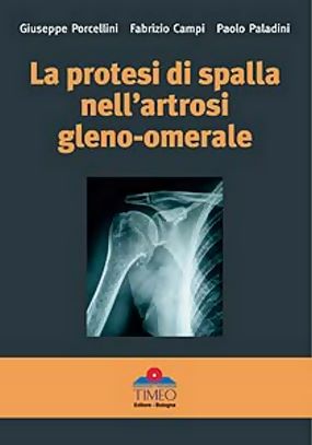 La Protesi di Spalla nell'artrosi gleno-omerale (trovasi anche la versione inglese)