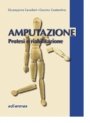 Amputazione - Protesi e riabilitazione