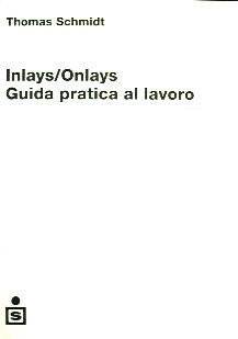 Inlays-Onlays: guida pratica al lavoro