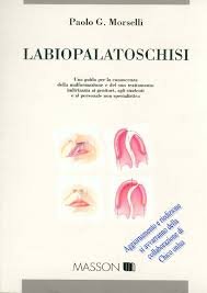 Labiopalatoschisi