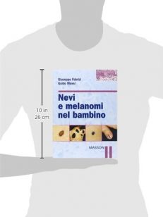 Nevi e melanomi nel bambino