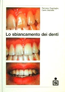 Lo sbiancamento dei denti - immagine 2