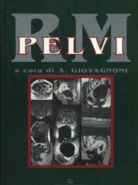 RM pelvi