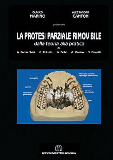 La protesi parziale rimovibile - Dalla teoria alla pratica