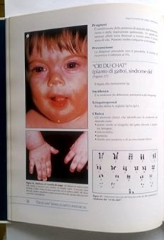 Dizionario illustrato delle malattie malformative e delle sindromi congenite pediatriche