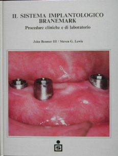 Il sistema implantologico Branemark