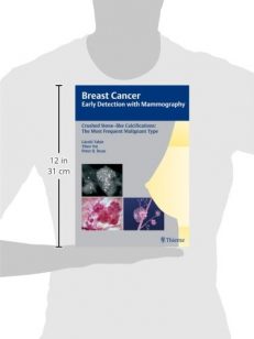 Crushed Stone-like Calcification: The most frequent Malignant type