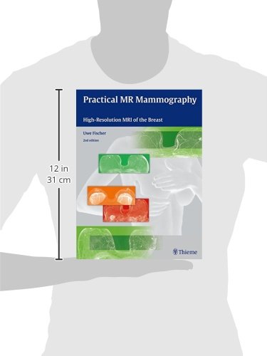 Practical MR Mammography: High Resolution MRI of the Breast - immagine 2