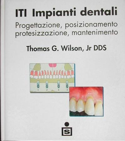 ITI impianti dentali