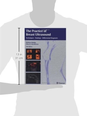 The Practice of Breast Ultrasound: Techniques, Findings, Differential Diagnosis