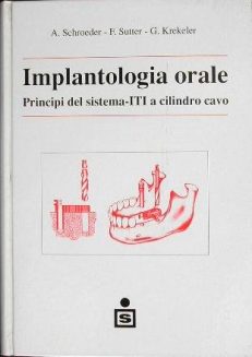 Implantologia orale. Principi del sistema ITI a cilindro cavo