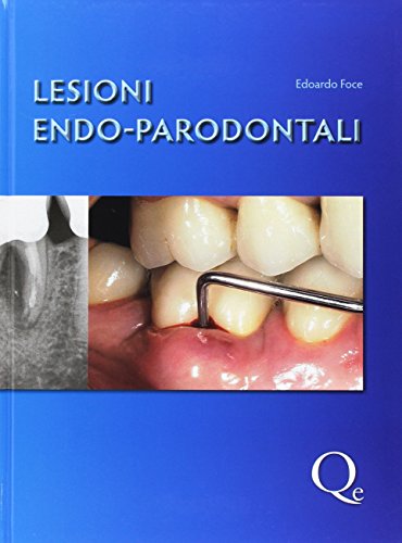 Lesioni endo-parodontali - immagine 3