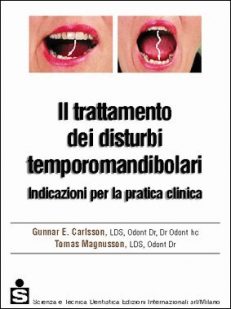 Il trattamento dei disturbi temporomandibolari