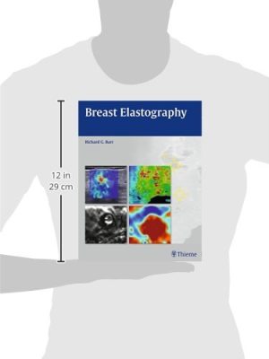 Breast Elastography