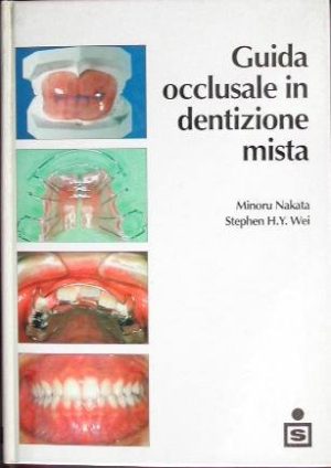 Guida occlusale in dentizione mista