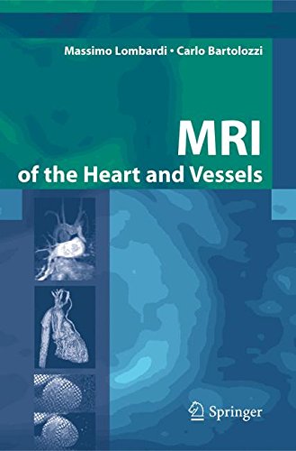 MRI of the heart and vessels - immagine 4