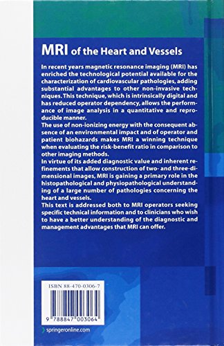 MRI of the heart and vessels - immagine 2