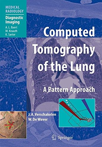 Computed Tomography of the Lung: A Pattern Approach - immagine 2