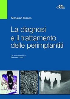 La diagnosi e il trattamento delle perimplantiti