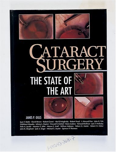 Cataract Surgery: The State of the Art - immagine 2