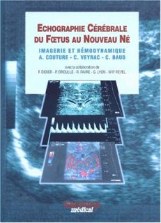 Echographie Cérébrale du Foetus au Nouveau Né : Imagerie et hémodynamique