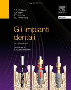 Gli impianti dentali