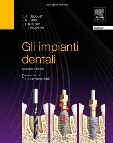 Gli impianti dentali - immagine 2