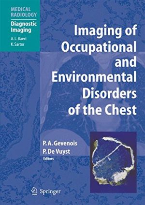 Imaging of Occupational And Environmental Disorders of the Chest