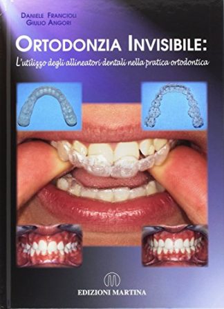 Ortodonzia invisibile. L'utilizzo degli allineatori dentali nella pratica ortodontica