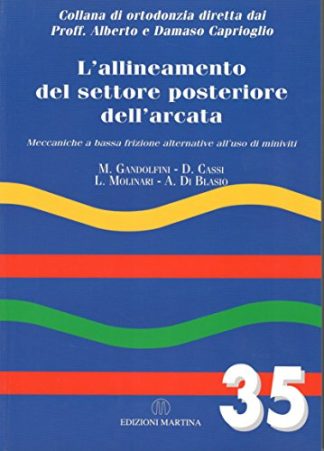 L'allineamento del settore posteriore dell'arcata. Meccaniche a bassa frizione alternative all'uso di miniviti