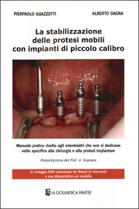 La stabilizzazione delle protesi mobili con impianti di piccolo calibro. Con DVD