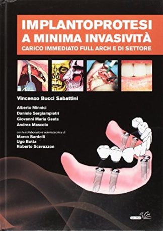 Implantoprotesi a minima invasività. Carico immediato full arch e di settore